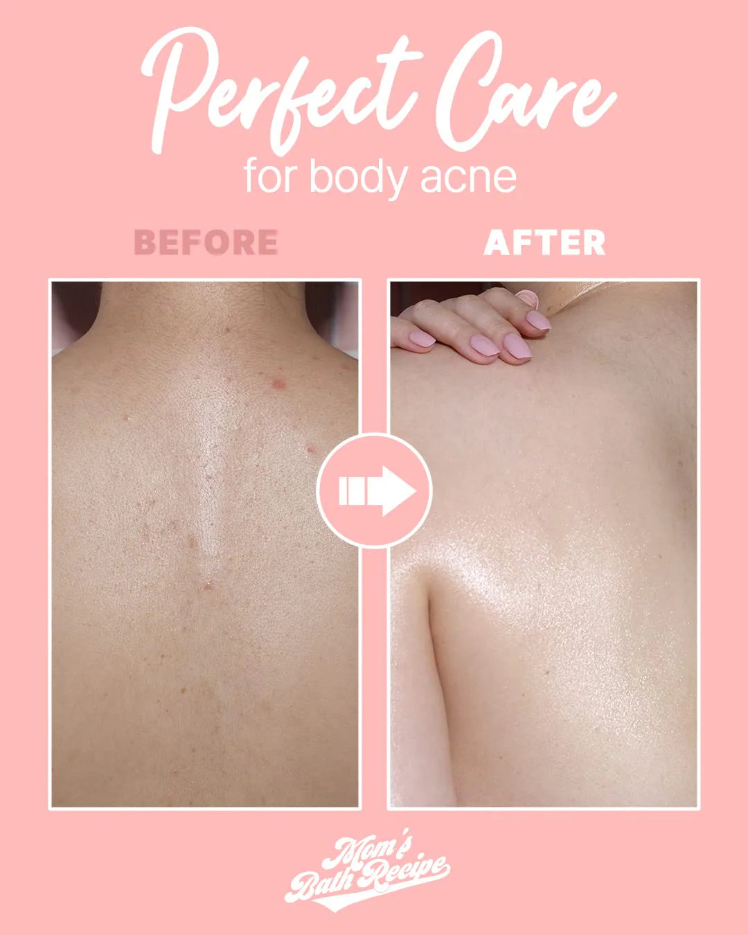 Mom’s Bath Recipe Body Peeling Pad Trouble Care (8 Sheets) - ZM Cosmetics
