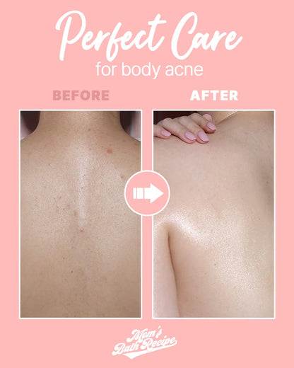 Mom’s Bath Recipe Body Peeling Pad Trouble Care (8 Sheets) - ZM Cosmetics