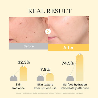 medicube Kojic Acid Turmeric Brightening Gold Jelly Gel Mask | Korean Skincare, 28g x 4ea