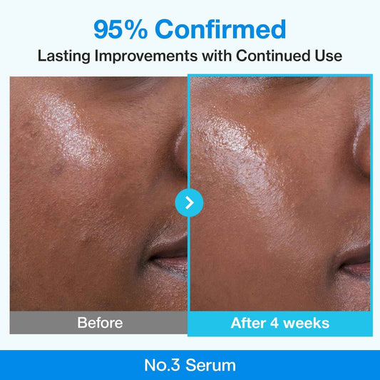 numbuzin No.3 Serum | Blue Retinol Pore Refining Serum