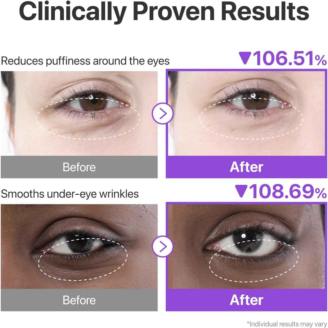numbuzin No.9 Eye Patches | NAD+ Collagen Under Eye Patches