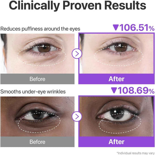 numbuzin No.9 Eye Patches | NAD+ Collagen Under Eye Patches