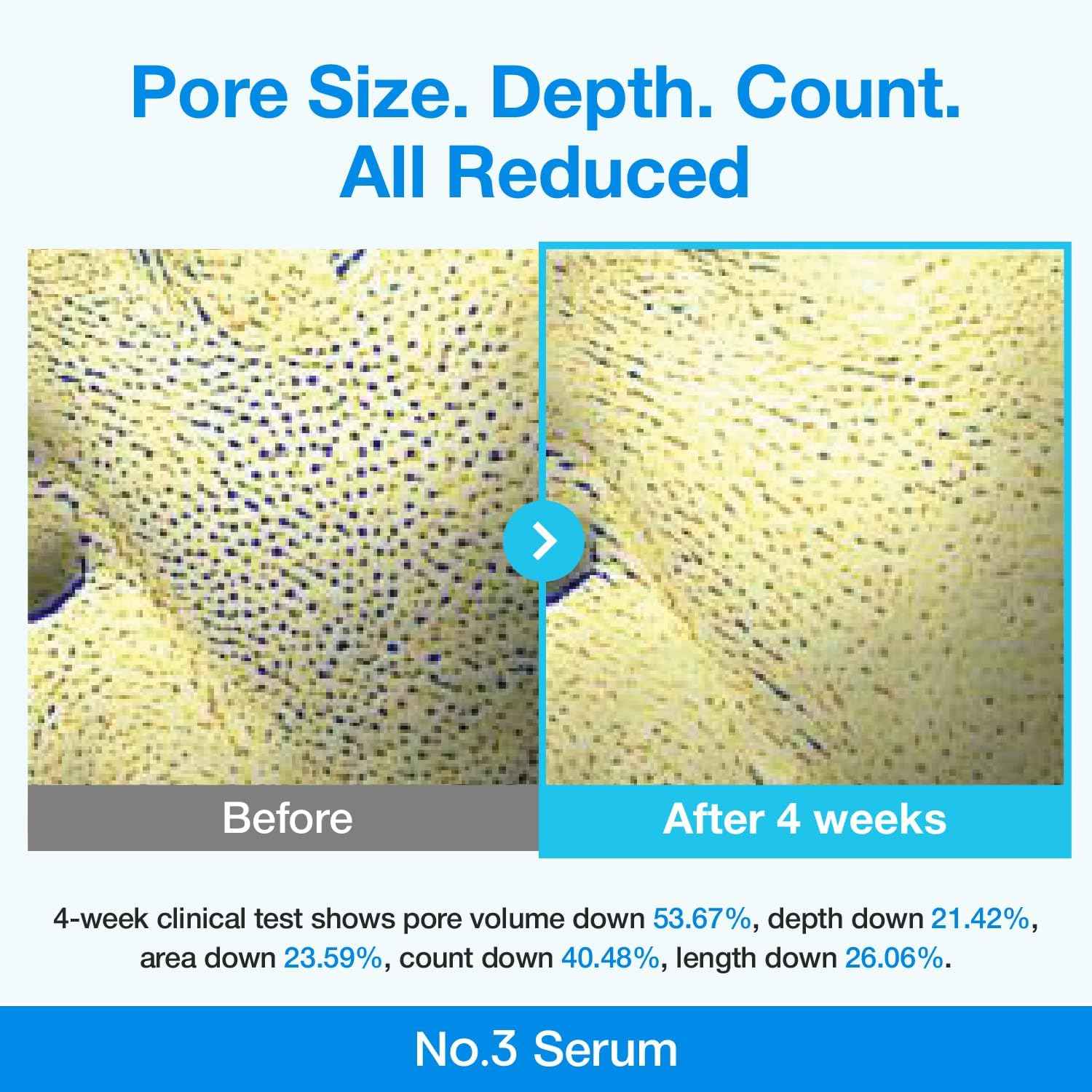 numbuzin No.3 Serum | Blue Retinol Pore Refining Serum