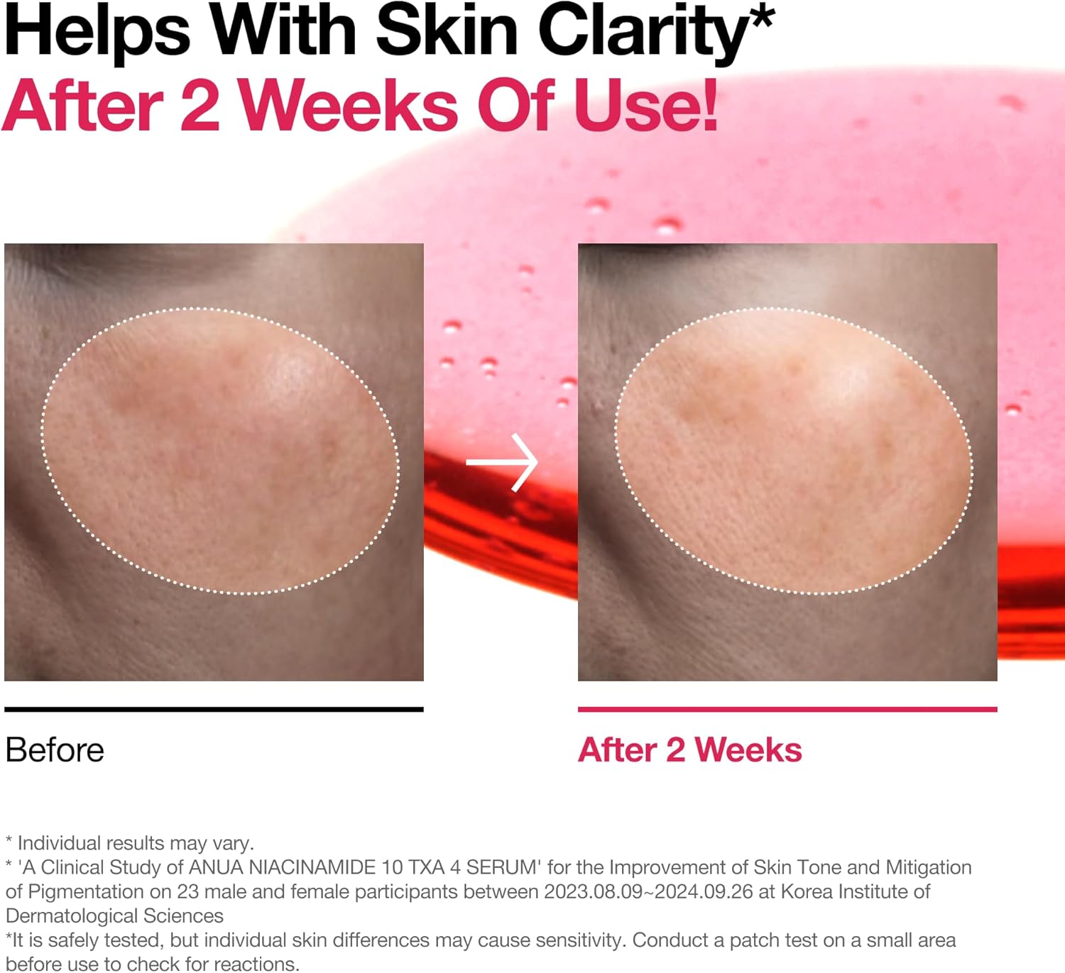 ANUA 10% Niacinamide+ 4% TXA Serum, Ceramide, Hyaluronic Acid, Tranexamic Acid, Vitamin B12 Natural color, Korean Glass Skin, Fragrance-Free, Dark Spot Serum, Korean Skincare - ZM Cosmetics