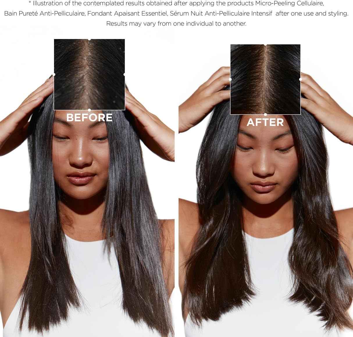 Kérastase Symbiose Anti-Dandruff Shampoo for Oily Scalp | Purifying Shampoo for Flakes and Scalp Comfort | 250ml