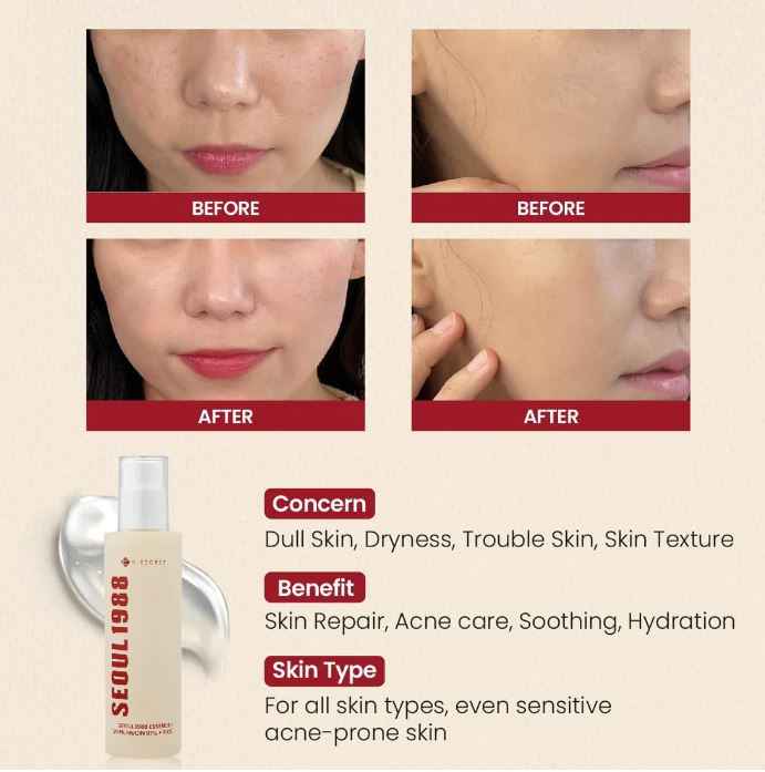 K-Secret Seoul 1988 Essence Snail Mucin 97% + Rice 100ml